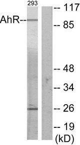 AHR Antibody - Western blot analysis of lysates from 293 cells, using AhR Antibody. The lane on the right is blocked with the synthesized peptide.