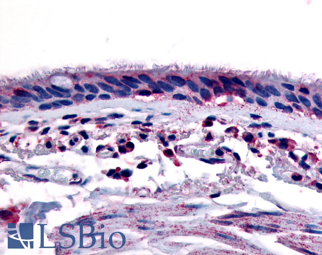 AHR Antibody - Anti-Aryl Hydrocarbon Receptor antibody IHC of human respiratory epithelium and bronchial smooth muscle. Immunohistochemistry of formalin-fixed, paraffin-embedded tissue after heat-induced antigen retrieval.