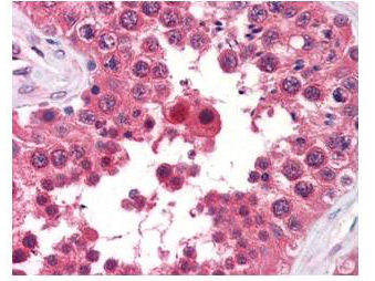 AHSA1 / AHA1 Antibody - Anti-AHA1 Monoclonal Antibody - Immunohistochemistry. anti-AHA1 monoclonal antibody was used at a 5-10 ug/mL to detect AHA1 in the seminiferous tubule of human testis (40X) showing moderate staining. Leydig cells showed faint to moderate staining. expression of AHA1 is reported in many epithelial and lymphatic tissues, with cytoplasmic localization. This antibody showed moderate cytoplasmic staining of a variety of epithelial tissues and lymphoid organs such as spleen and tonsil with minimal background staining. The image shows the localization of the antibody as the precipitated red signal, with a hematoxylin purple nuclear counterstain. Tissue was formalin-fixed and paraffin embedded. 