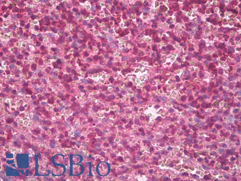 AHSA1 / AHA1 Antibody - Anti-AHSA1 / AHA1 antibody IHC of human spleen. Immunohistochemistry of formalin-fixed, paraffin-embedded tissue after heat-induced antigen retrieval. Antibody dilution 1:200.  This image was taken for the unconjugated form of this product. Other forms have not been tested.