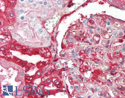 AHSG / Fetuin A Antibody - Human Kidney: Formalin-Fixed, Paraffin-Embedded (FFPE)