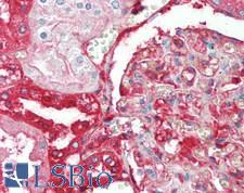 AHSG / Fetuin A Antibody - Human Kidney: Formalin-Fixed, Paraffin-Embedded (FFPE)