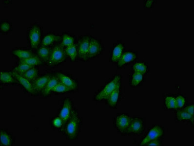 AHSG / Fetuin A Antibody - Immunofluorescent analysis of HepG2 cells using AHSG Antibody at dilution of 1:100 and Alexa Fluor 488-congugated AffiniPure Goat Anti-Rabbit IgG(H+L)