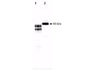 AHSG / Fetuin A Antibody - Anti-Fetuin Antibody - Western Blot. Western blot of Fetuin. Anti-Human Fetuin antibody, generated by immunization with mature protein, was tested by western blot against fetuin in purified preparations and in human plasma. Lane 1 contains 250 ng of purified human fetuin. Lane 2 contains 5 ul of a 1:50 dilution of human serum. Dilution of Anti-Human Fetuin antibody between 1:10000 and 1:20000 showed strong reactivity by western blot. In this blot the antibody was used at a 1:10000 dilution incubated 1 h at room temperature in 1% BSA in TTBS. Detection occurred using a 1:5000 dilution of IRDye800 conjugated Donkey anti-Goat IgG (code # for 45 min at room temperature. LICORs Odyssey Infrared Imaging System was used to scan and process the image. Other detection systems will yield similar results.