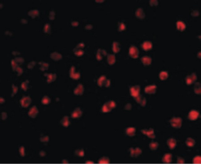 AICDA / AID Antibody - Immunofluorescence of AID in Ramos cells with AID antibody at 20 ug/ml.