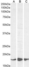 AIF1 / IBA1 Antibody - AIF1 / IBA1 (isoform 1 and 3) Antibody (1µg/ml) staining of Human (A) and (0.5ug/ml) of Mouse (B) and Rat (C) Brain lysate (35µg protein in RIPA buffer). Primary incubation was 1 hour. Detected by chemiluminescencence.