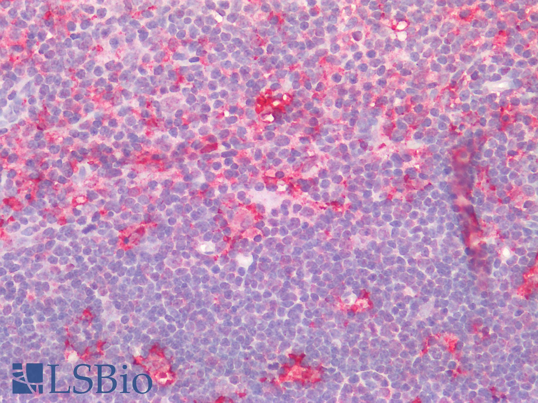 AIF1 / IBA1 Antibody - Human Thymus: Formalin-Fixed, Paraffin-Embedded (FFPE) HIER using 10 mM sodium citrate buffer pH 6.0