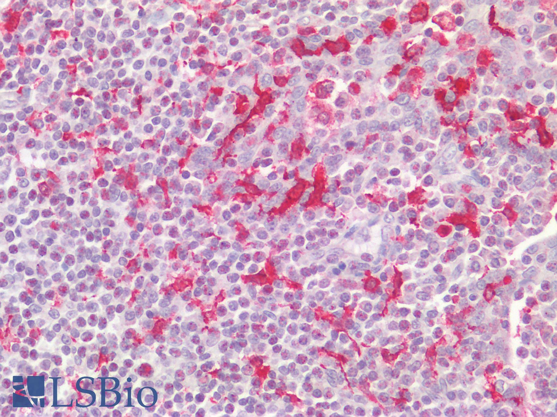 AIF1 / IBA1 Antibody - Human Tonsil: Formalin-Fixed, Paraffin-Embedded (FFPE) HIER using 10 mM sodium citrate buffer pH 6.0