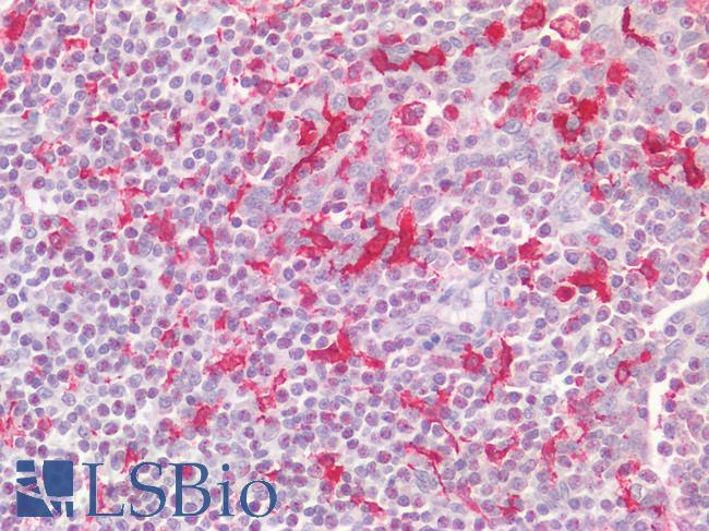 AIF1 / IBA1 Antibody - Human Tonsil: Formalin-Fixed, Paraffin-Embedded (FFPE) HIER using 10 mM sodium citrate buffer pH 6.0