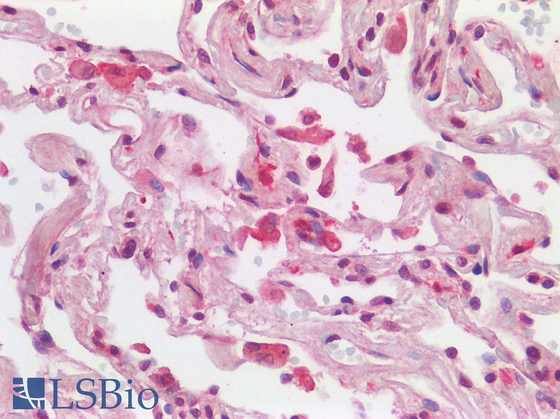 AIF1 / IBA1 Antibody - Human Lung: Formalin-Fixed, Paraffin-Embedded (FFPE) HIER using 10 mM sodium citrate buffer pH 6.0