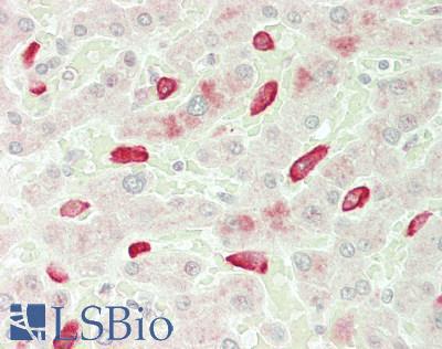 AIF1 / IBA1 Antibody - Human Liver: Formalin-Fixed, Paraffin-Embedded (FFPE)