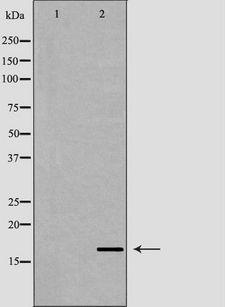 AIF1 / IBA1 Antibody - Western blot analysis of extracts of mouse spleen using AIF1 antibody. The lane on the left is treated with the antigen-specific peptide.