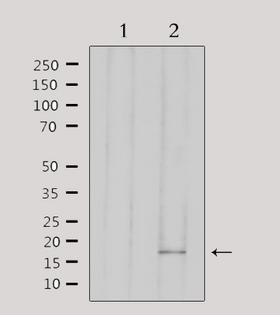 AIF1 / IBA1 Antibody - Western blot analysis of extracts of 293 cells using AIF1 antibody. Lane 1 was treated with the antigen-specific peptide.