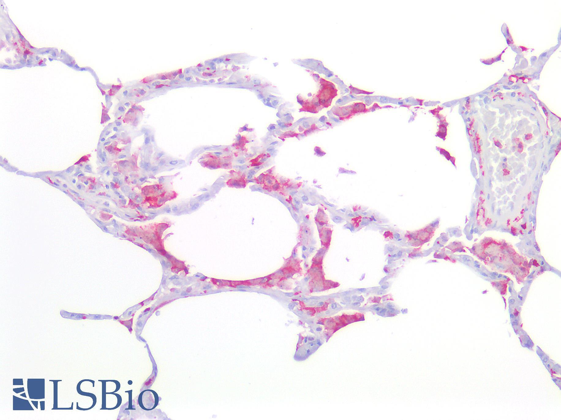 AIF1 / IBA1 Antibody - Human Lung: Formalin-Fixed, Paraffin-Embedded (FFPE)