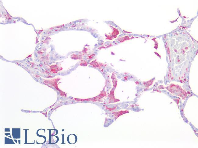 AIF1 / IBA1 Antibody - Human Lung: Formalin-Fixed, Paraffin-Embedded (FFPE)