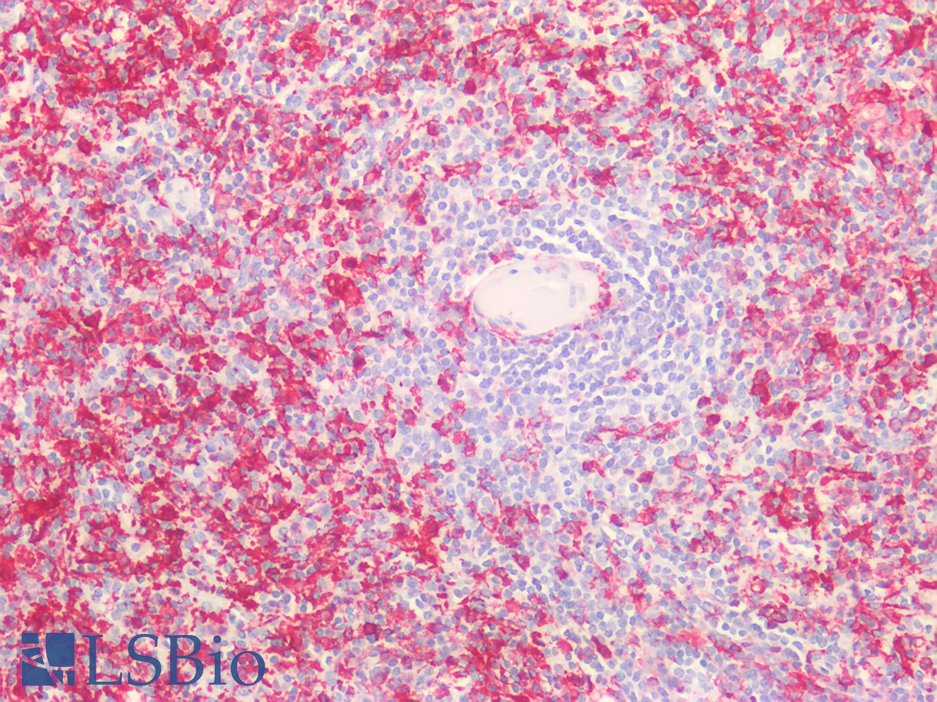 AIF1 / IBA1 Antibody - Human Spleen: Formalin-Fixed, Paraffin-Embedded (FFPE)