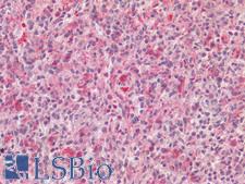 AIF1 / IBA1 Antibody - Human Spleen: Formalin-Fixed, Paraffin-Embedded (FFPE) HIER using 10 mM sodium citrate buffer pH 6.0