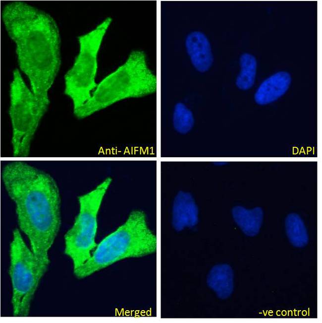 AIFM1 / AIF / PDCD8 Antibody - AIFM1 / AIF / PDCD8 antibody immunofluorescence analysis of paraformaldehyde fixed HeLa cells, permeabilized with 0.15% Triton. Primary incubation 1hr (10ug/ml) followed by Alexa Fluor 488 secondary antibody (4ug/ml), showing Mitochondrial staining. The nuclear stain is DAPI (blue). Negative control: Unimmunized goat IgG (10ug/ml) followed by Alexa Fluor 488 secondary antibody (2ug/ml).