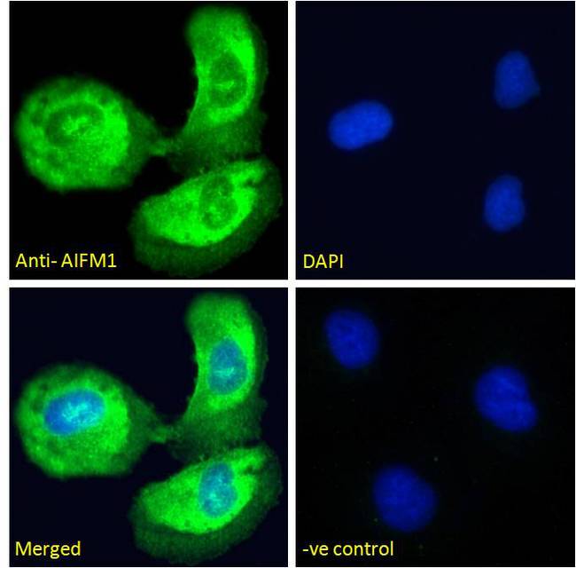 AIFM1 / AIF / PDCD8 Antibody - AIFM1 / AIF / PDCD8 antibody immunofluorescence analysis of paraformaldehyde fixed U2OS cells, permeabilized with 0.15% Triton. Primary incubation 1hr (10ug/ml) followed by Alexa Fluor 488 secondary antibody (4ug/ml), showing Mitochondrial staining. The nuclear stain is DAPI (blue). Negative control: Unimmunized goat IgG (10ug/ml) followed by Alexa Fluor 488 secondary antibody (2ug/ml).