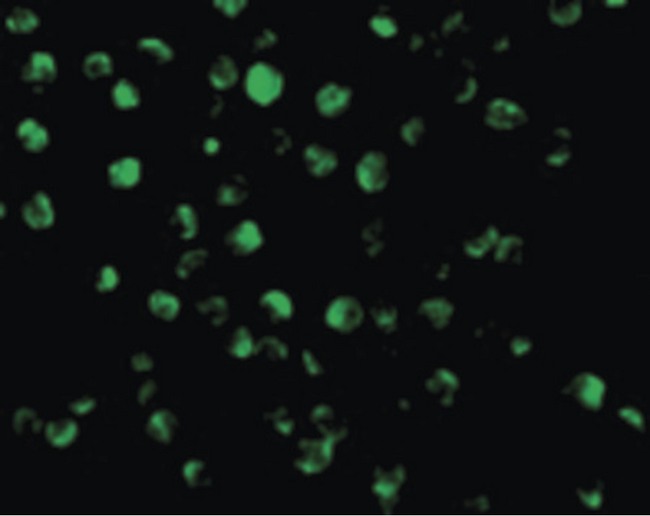 AIFM1 / AIF / PDCD8 Antibody - Immunofluorescence of AIF in K562 cells with AIF antibody at 20 ug/ml.