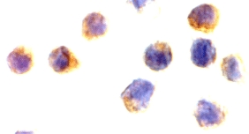 AIFM1 / AIF / PDCD8 Antibody - Immunocytochemistry of AIF in Jurkat cells with AIF antibody at 2 µg/ml.