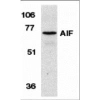 AIFM1 / AIF / PDCD8 Antibody - Western blot analysis of AIF in K562 cell lysate with AIF antibody at 1 µg/mL.