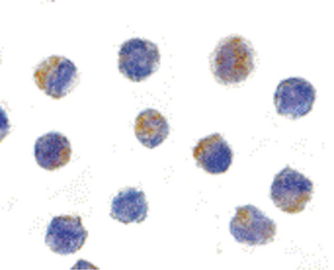AIFM1 / AIF / PDCD8 Antibody - Immunocytochemistry of AIF in K562 cells with AIF antibody at 5 ug/ml.