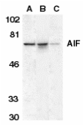AIFM1 / AIF / PDCD8 Antibody - Western blot of AIF in K562 cell lysate (A), mouse (B), and rat (C) liver tissue lysates with AIF antibody at 1 ug/ml.