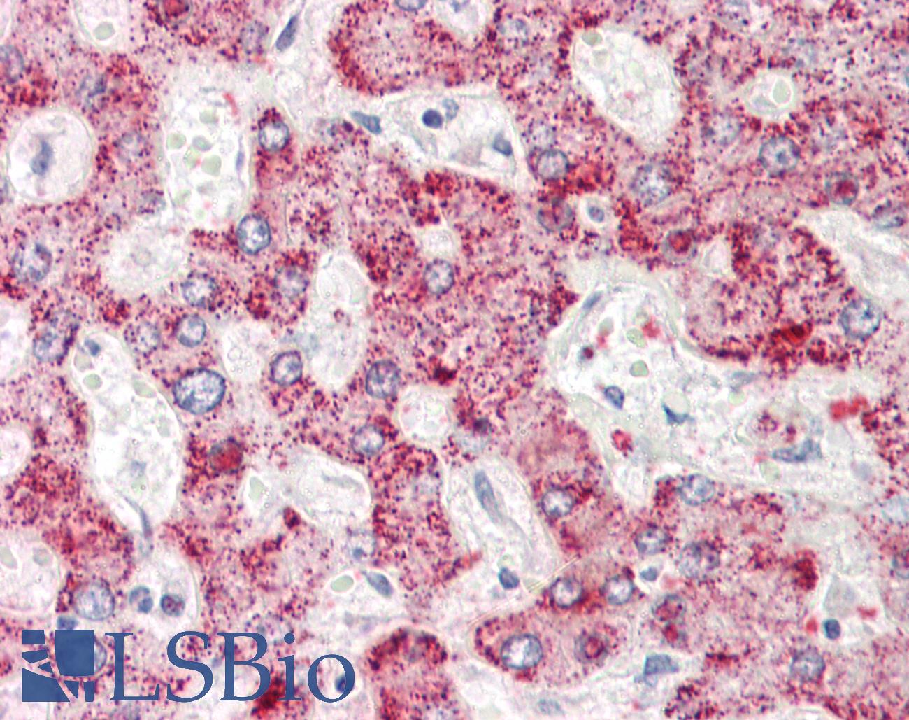 AIG1 Antibody - Anti-AIG1 antibody IHC staining of human liver. Immunohistochemistry of formalin-fixed, paraffin-embedded tissue after heat-induced antigen retrieval.