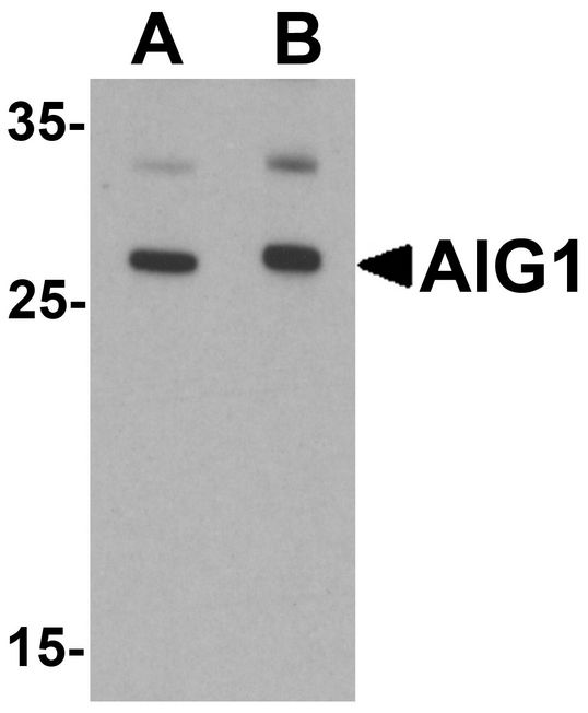 AIG1 Antibody - Western blot analysis of AIG1 in human brain tissue lysate with AIG1 antibody at (A) 1 and (B) 2 ug/ml.