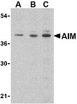 AIM / CD5L Antibody - Western blot of AIM in Raji lysate with AIM antibody at (A) 0.5, (B) 1 and (C) 2 g/ml.