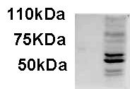 AIM2 Antibody - Antibody staining of IFNbeta-treated WI-38 lysate (35 ug protein in RIPA buffer). Primary incubation was 1 hour. Detected by chemiluminescence.