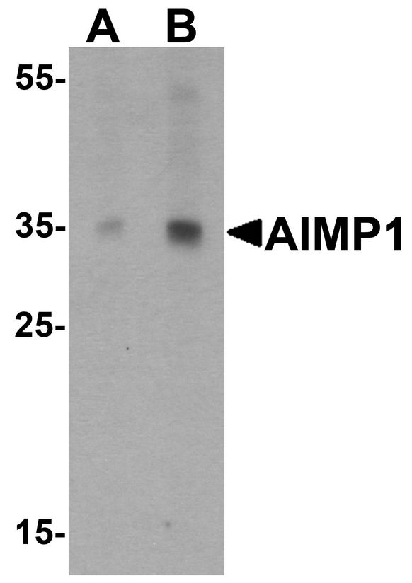 AIMP1 / EMAP II Antibody - Western blot analysis of AIMP1 in rat brain tissue lysate with AIMP1 antibody at (A) 0.5 and (B) 1 ug/ml.