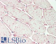 AIMP1 / EMAP II Antibody - Human Skeletal Muscle: Formalin-Fixed, Paraffin-Embedded (FFPE)