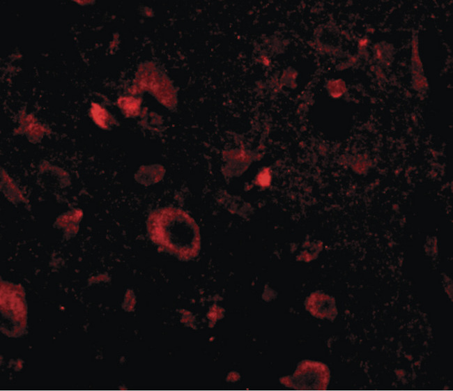 AIPL1 Antibody - Immunofluorescence of aipl1 in human brain tissue with aipl1 antibody at 20 ug/ml.