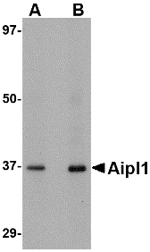 AIPL1 Antibody - Western blot of Aipl1 in human brain tissue lysate with Aipl1 antibody at (A) 1 and (B) 2 ug/ml.