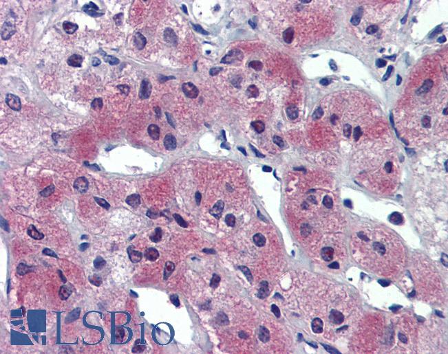 AIPL1 Antibody - Anti-AIPL1 antibody IHC of human adrenal. Immunohistochemistry of formalin-fixed, paraffin-embedded tissue after heat-induced antigen retrieval. Antibody concentration 5 ug/ml.