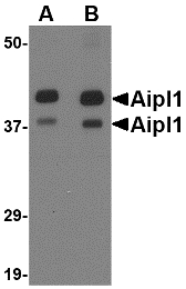 AIPL1 Antibody - Western blot of Aipl1 in rat brain tissue lysate with Aipl1 antibody at (A) 1 and (B) 2 ug/ml.
