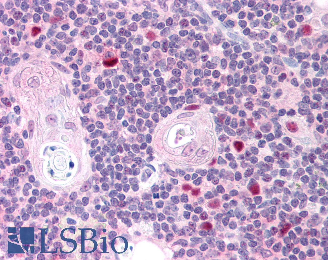 AIRE Antibody - Anti-AIRE antibody IHC of human thymus. Immunohistochemistry of formalin-fixed, paraffin-embedded tissue after heat-induced antigen retrieval. Antibody concentration 5 ug/ml.