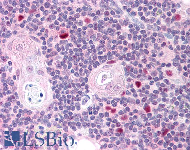 AIRE Antibody - Anti-AIRE antibody IHC of human thymus. Immunohistochemistry of formalin-fixed, paraffin-embedded tissue after heat-induced antigen retrieval. Antibody concentration 5 ug/ml.