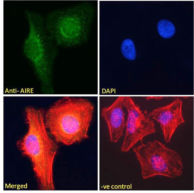 AIRE Antibody - AIRE antibody immunofluorescence analysis of paraformaldehyde fixed HeLa cells, permeabilized with 0.15% Triton. Primary incubation 1hr (10ug/ml) followed by Alexa Fluor 488 secondary antibody (2ug/ml), showing nucleoplasm and nuclear membrane staining. Actin filaments were stained with phalloidin (red) and the nuclear stain is DAPI (blue). Negative control: Unimmunized goat IgG (10ug/ml) followed by Alexa Fluor 488 secondary antibody (2ug/ml).