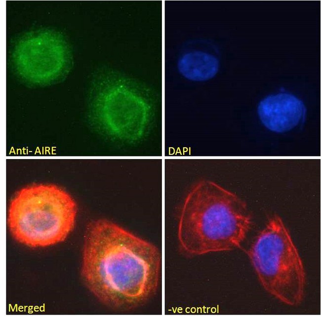 AIRE Antibody - AIRE antibody immunofluorescence analysis of paraformaldehyde fixed U2OS cells, permeabilized with 0.15% Triton. Primary incubation 1hr (10ug/ml) followed by Alexa Fluor 488 secondary antibody (2ug/ml), showing nucleoplasm and nuclear membrane staining. Actin filaments were stained with phalloidin (red) and the nuclear stain is DAPI (blue). Negative control: Unimmunized goat IgG (10ug/ml) followed by Alexa Fluor 488 secondary antibody (2ug/ml).