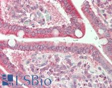 AIRE Antibody - Human Small Intestine: Formalin-Fixed, Paraffin-Embedded (FFPE)