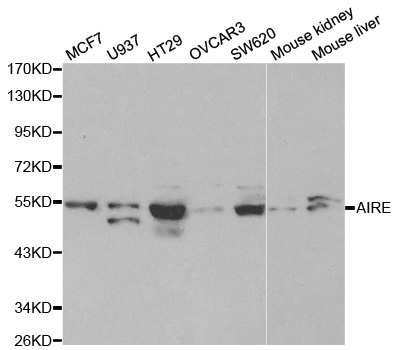 AIRE Antibody - Western blot analysis of extracts of various cell lines, using AIRE antibody at 1:1000 dilution. The secondary antibody used was an HRP Goat Anti-Rabbit IgG (H+L) at 1:10000 dilution. Lysates were loaded 25ug per lane and 3% nonfat dry milk in TBST was used for blocking.