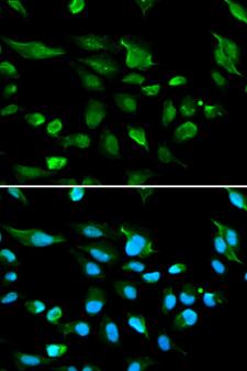 AIRE Antibody - Immunofluorescence analysis of A549 cells using AIRE antibody. Blue: DAPI for nuclear staining.
