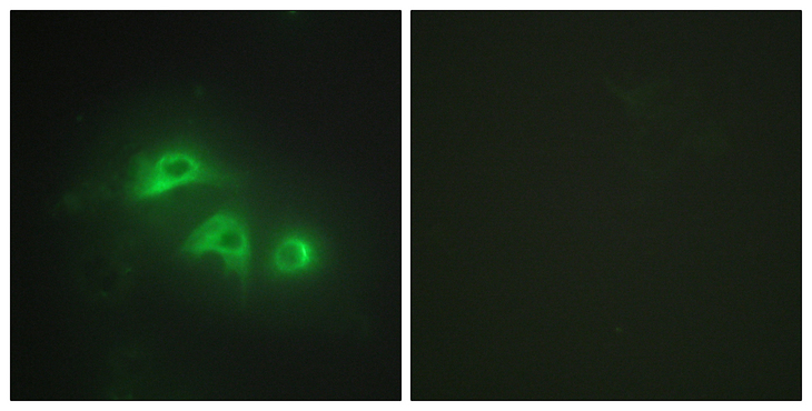 AK1 / Adenylate Kinase 1 Antibody - Immunofluorescence analysis of HepG2 cells, using KAD1 Antibody . The picture on the right is blocked with the synthesized peptide.