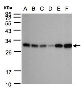 AK4 / Adenylate Kinase 4 Antibody - Sample (30 ug whole cell lysate). A:293T, B: A431 , C: H1299, D: HeLa S3 , E: Hep G2 . F: Raji . 12% SDS PAGE. AK4 / Adenylate Kinase 4 antibody diluted at 1:1000