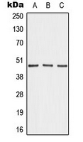 AKAP5 / AKAP79 Antibody - Western blot analysis of AKAP5 expression in MDAMB231 (A); NIH3T3 (B); H9C2 (C) whole cell lysates.