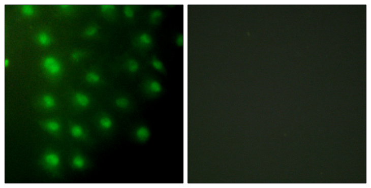 AKAP8 / AKAP95 Antibody - Immunofluorescence analysis of HUVEC cells, using AKAP8 Antibody. The picture on the right is blocked with the synthesized peptide.