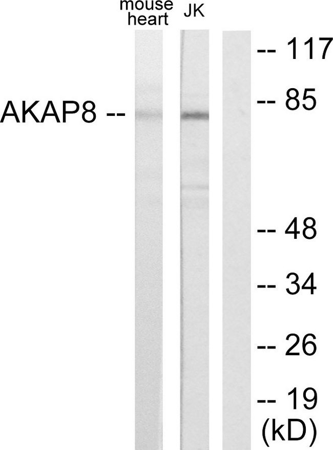 AKAP8 / AKAP95 Antibody - Western blot analysis of lysates from mouse heart and Jurkat cells, using AKAP8 Antibody. The lane on the right is blocked with the synthesized peptide.